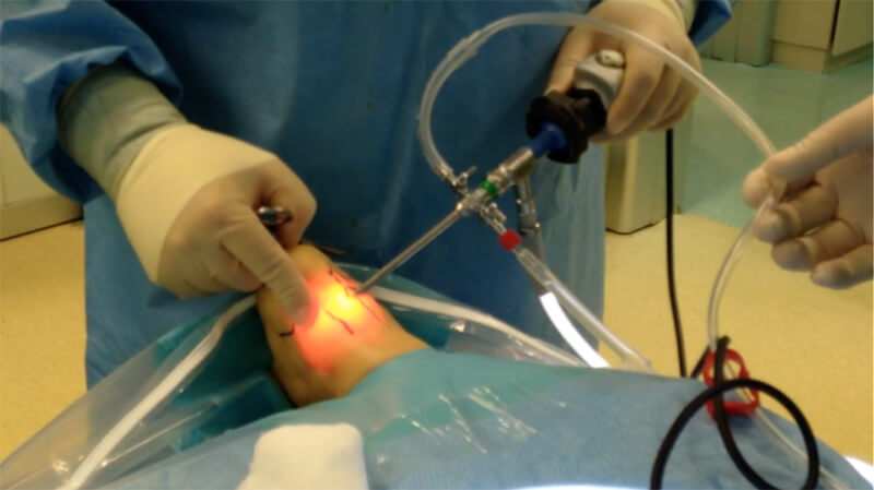 Σύγχρονη χειρουργική ποδιού