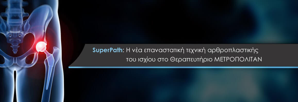 SuperPath